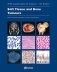 Soft Tissue and Bone Tumours фото книги маленькое 2