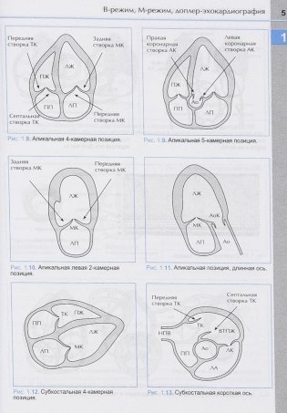 Справочник по эхокардиографии фото книги 6