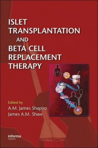 Islet transplantation and beta cell replacement therapy / фото книги
