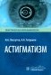 Астигматизм фото книги маленькое 2