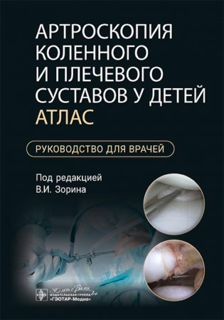 Артроскопия коленного и плечевого суставов у детей. Атлас : руководство для врачей фото книги