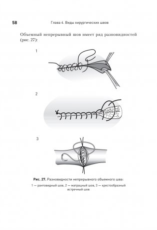 Хирургический шов. 3-е издание, обновленное фото книги 14
