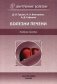 Болезни печени. Учебное пособие. Гриф УМО по медицинскому образованию фото книги маленькое 2