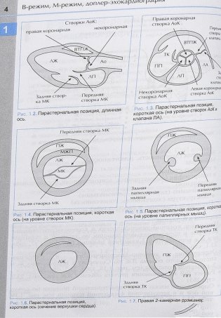 Справочник по эхокардиографии фото книги 5