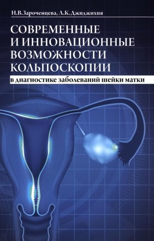 Современные и инновационные возможности кольпоскопии в диагностике заболеваний шейки матки. 2-е изд., доп.и перераб фото книги