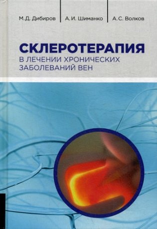 Склеротерапия в лечении хронических заболеваний вен фото книги