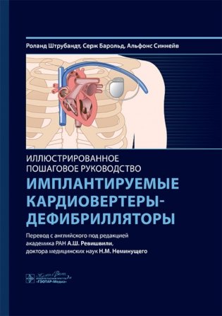 Имплантируемые кардиовертеры-дефибрилляторы. Иллюстрированное пошаговое руководство фото книги