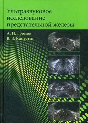 Ультразвуковое исследование предстательной железы фото книги