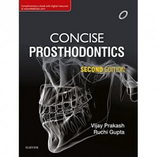 Concise Prosthodontics фото книги