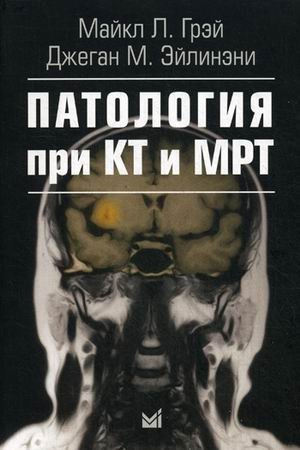 Патология при КТ и МРТ фото книги