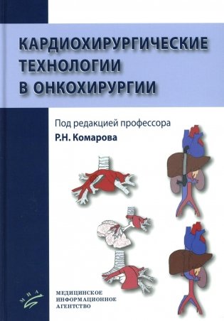 Кардиохирургические технологии в онкохирургии фото книги