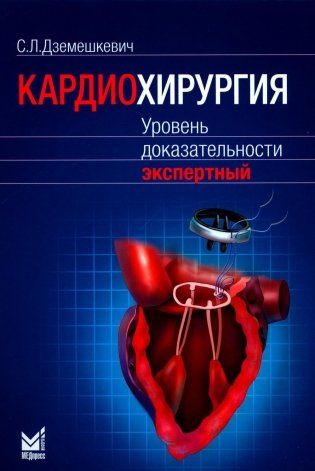 Кардиохирургия. Уровень доказательности экспертный фото книги
