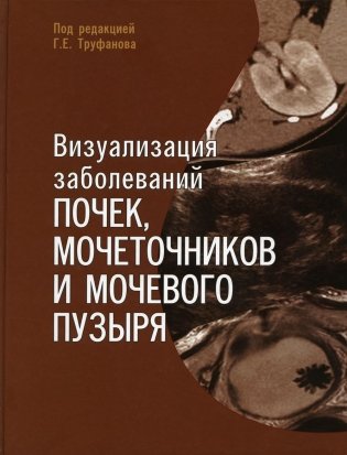Визуализация заболеваний почек, мочеточников и мочевого пузыря: Учебное пособие фото книги