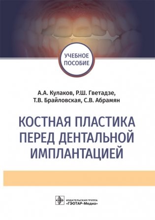 Костная пластика перед дентальной имплантацией фото книги