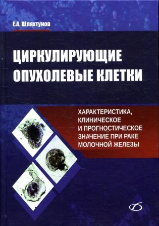 Циркулирующие опухолевые клетки: характеристика, клиническое и прогностическое значение при раке молочной железы фото книги