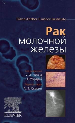 Рак молочной железы фото книги