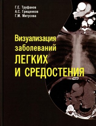 Визуализация заболеваний легких и средостения фото книги