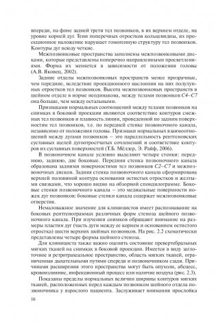 Рентгенометрия позвоночника фото книги 16