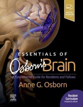 Essentials of osborn`s brain фото книги