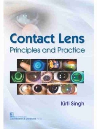 Contact Lens Principles And Practice (Pb 2017) фото книги