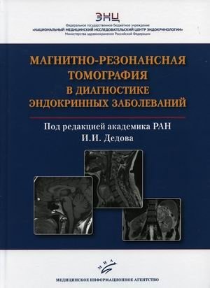 Магнитно-резонансная томография в диагностике эндокринных заболеваний фото книги
