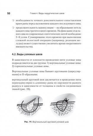 Хирургический шов. 3-е издание, обновленное фото книги 6