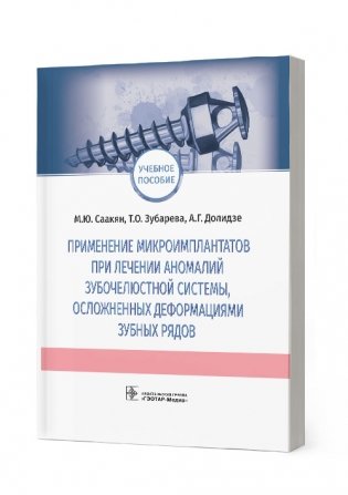 Применение микроимплантатов при лечении аномалий зубочелюстной системы, осложненных деформациями зубных рядов фото книги