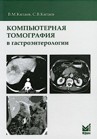 Компьютерная томография в гастроэнтерологии: руководство для врачей. 3-е изд., испр.и доп фото книги
