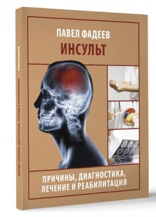 Инсульт. Причины, диагностика, лечение и реабилитация фото книги 2
