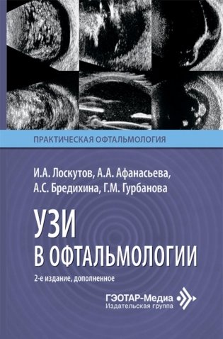 УЗИ в офтальмологии. 2-е изд., доп фото книги