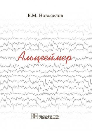 Альцгеймер фото книги