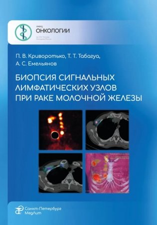 Биопсия сигнальных лимфатических узлов при раке молочной железы фото книги