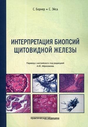 Интерпретация биопсий щитовидной железы фото книги