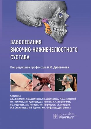 Заболевания височно-нижнечелюстного сустава фото книги
