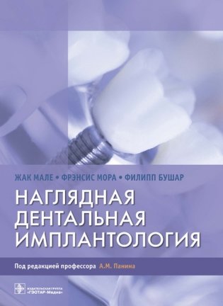 Наглядная дентальная имплантология фото книги