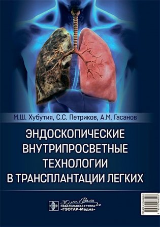 Эндоскопические внутрипросветные технологии в трансплантации легких фото книги