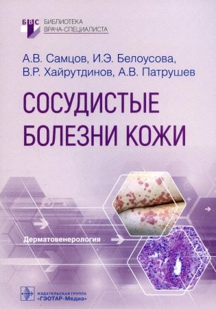 Сосудистые болезни кожи фото книги