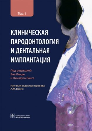 Клиническая пародонтология и дентальная имплантация. Том 1 фото книги