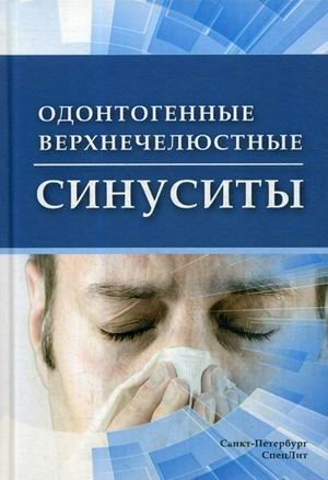 Одонтогенные верхнечелюстные синуситы фото книги
