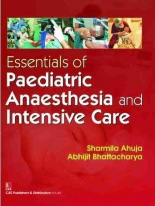 Essentials of Paediatric Anaesthesia and Intensive Care (PB) фото книги