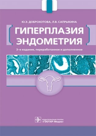 Гиперплазия эндометрия фото книги