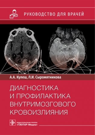 Диагностика и профилактика внутримозгового кровоизлияния фото книги
