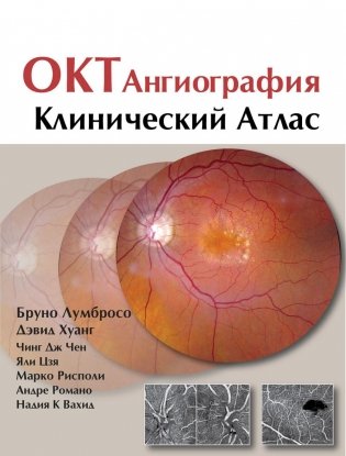ОКТ-ангиография. Клинический атлас фото книги