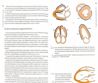 ЭхоКГ понятным языком фото книги 3