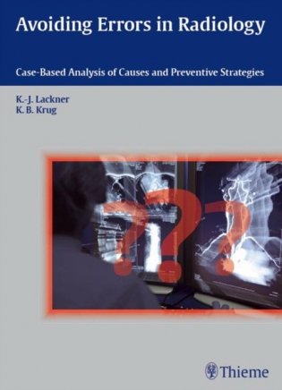 Avoiding Errors in Radiology: Case-Based Analysis of Causes and Preventive Strategies фото книги