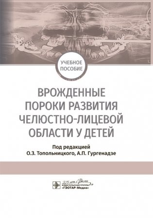 Врожденные пороки развития челюстно-лицевой области у детей фото книги