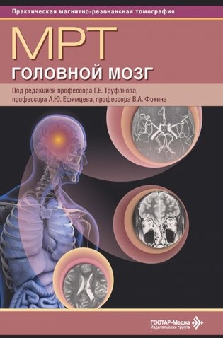 МРТ. Головной мозг: руководство для врачей фото книги