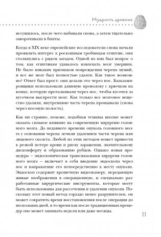 Дикая медицина. Шокирующие операции и факты из истории медицины фото книги 12