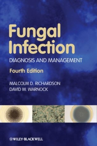 Fungal Infection: Diagnosis and Management, 4th Edition фото книги