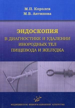 Эндоскопия в диагностике и удалении инородных тел пищевода и желудка фото книги